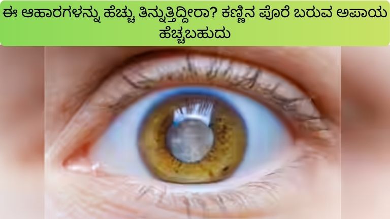 ಈ ಆಹಾರಗಳನ್ನು ಹೆಚ್ಚು ತಿನ್ನುತ್ತಿದ್ದೀರಾ ಕಣ್ಣಿನ ಪೊರೆ ಬರುವ ಅಪಾಯ ಹೆಚ್ಚಬಹುದು